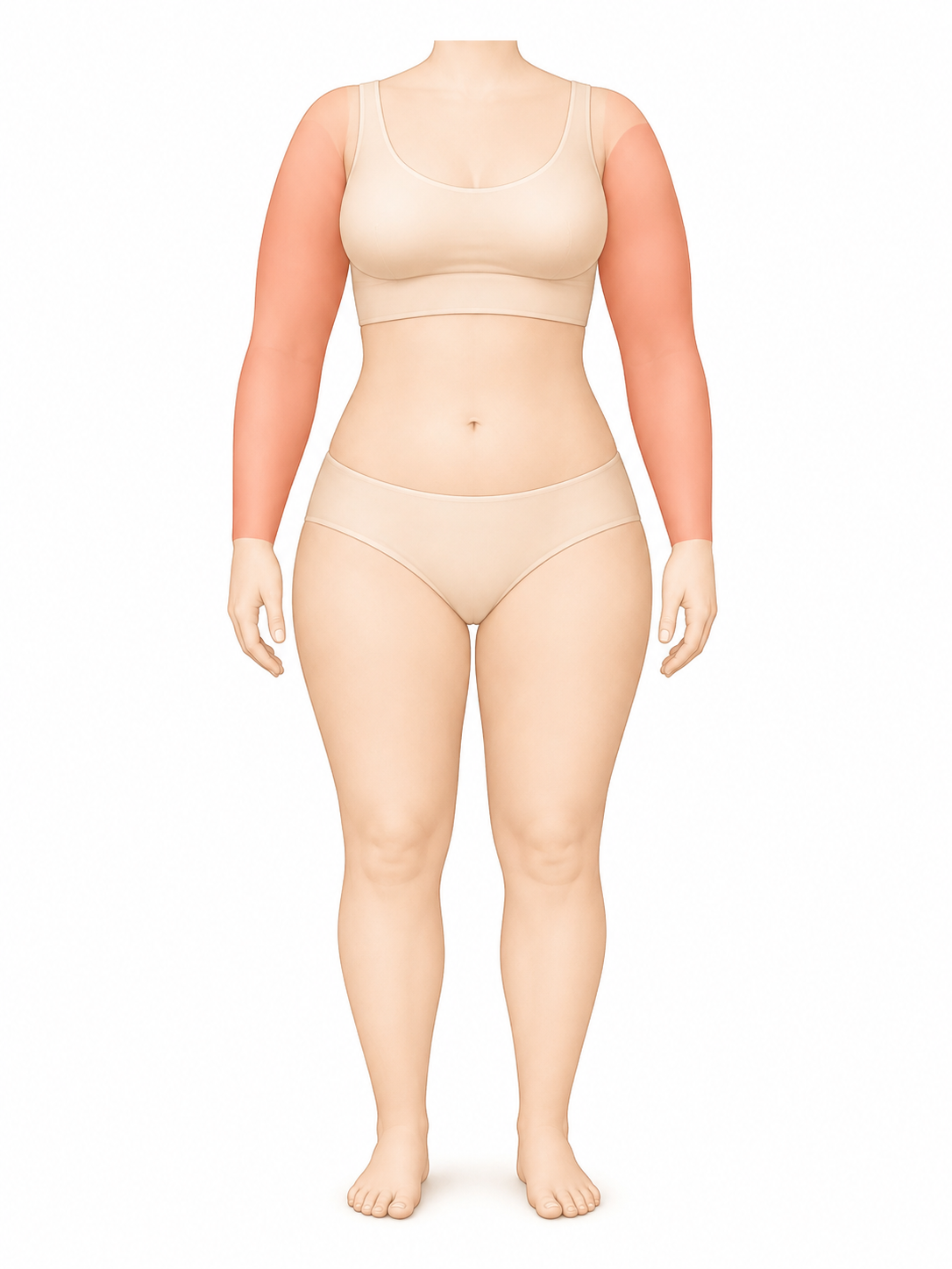 Lipedema tipo IV nos braços