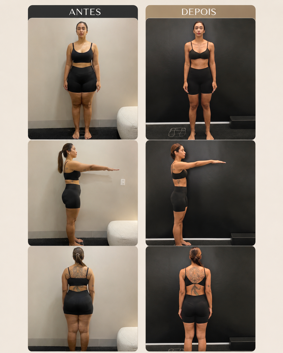 Comparação da evolução corporal antes e depois do acompanhamento para lipedema